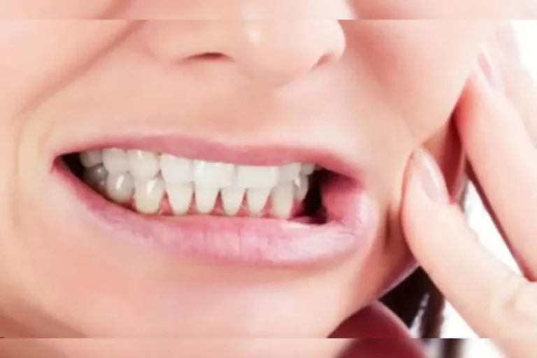 How to Maintain Healthy Gums and Teeth?